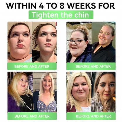 🌿Alcuras™ Moringa × Berberine × AMPK 8-Benefit Slimming & Metabolic Nano Microneedle Patch
