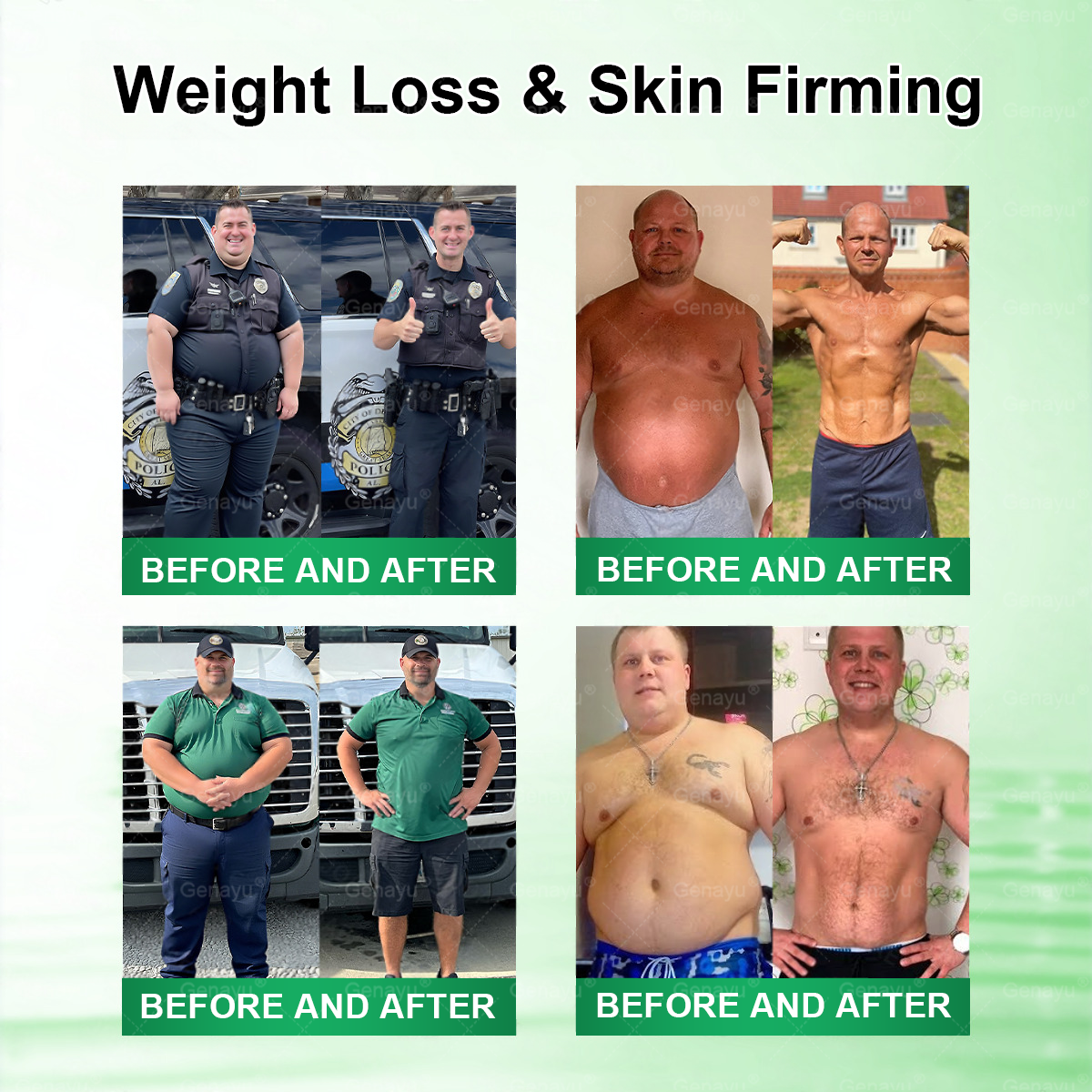 🌿Alcuras™ Moringa × Berberine × AMPK 8-Benefit Slimming & Metabolic Nano Microneedle Patch